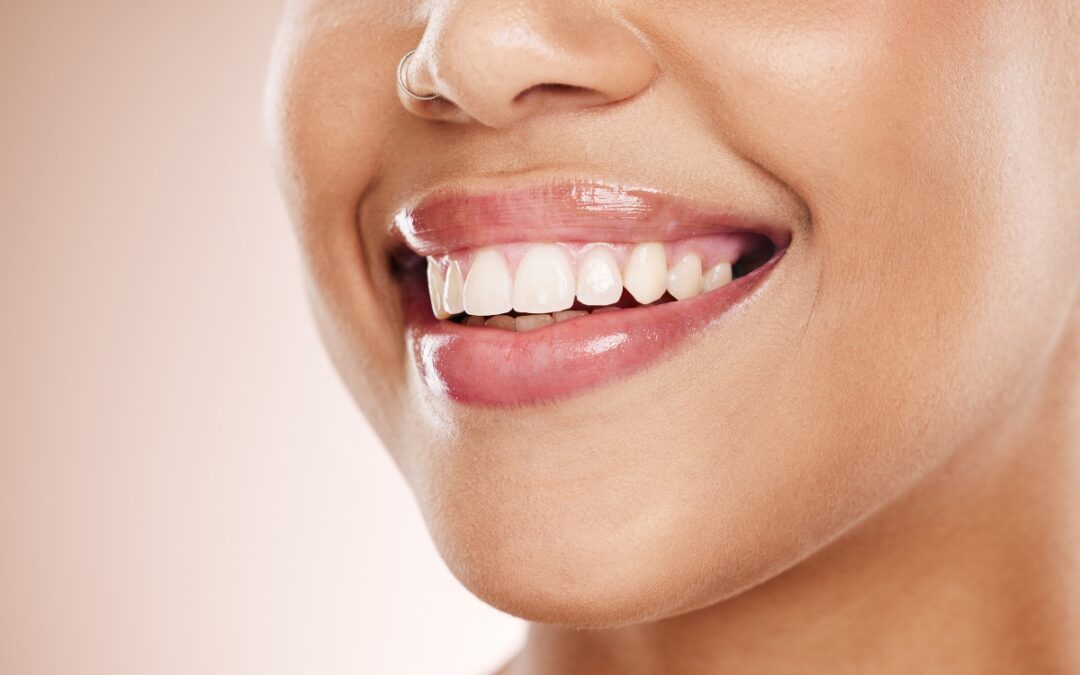 7 Questions to Ask Before You Choose Cosmetic Dentistry in Odessa