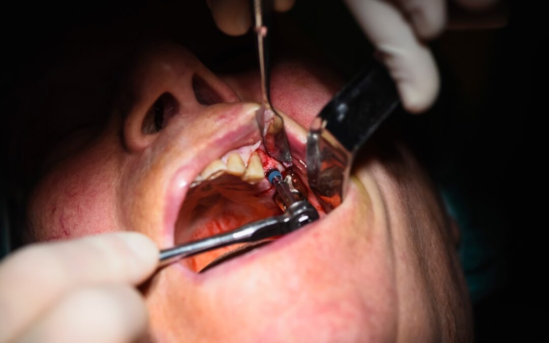 Is Oral Surgery Right for You? Signs and Treatment Options in Odessa