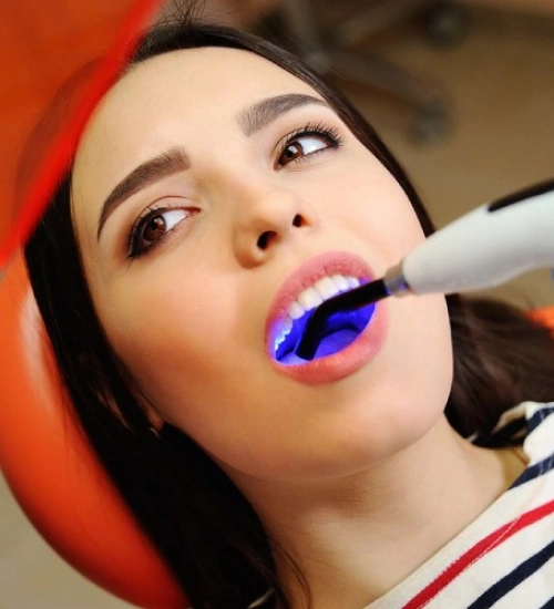 gold standard family dental odessa tx fillings image