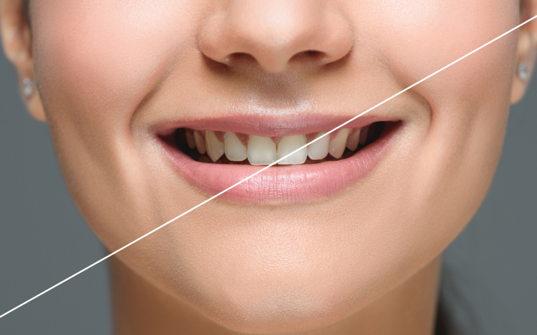 Brighten Your Smile and Boost Your Confidence