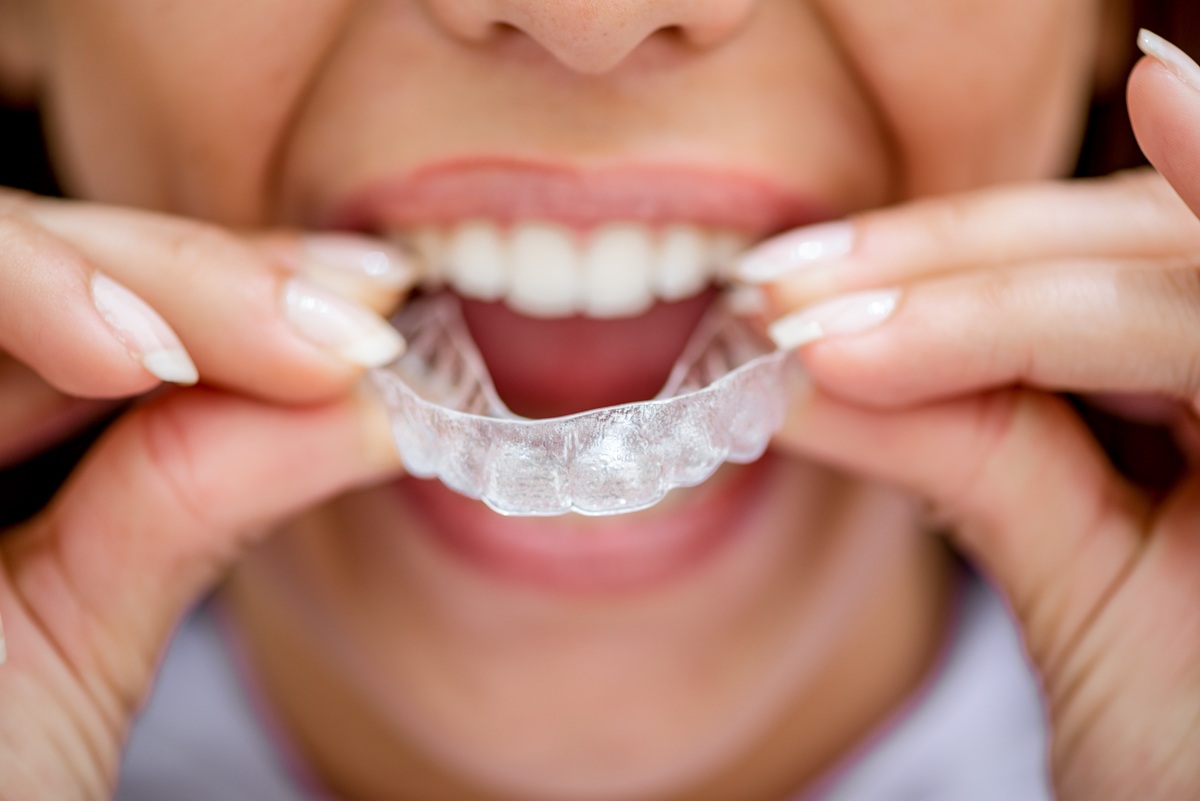 Patient using Invisalign for straighter smile
